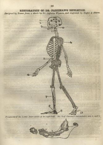 Restoration of Dr. Parkman's Skeleton